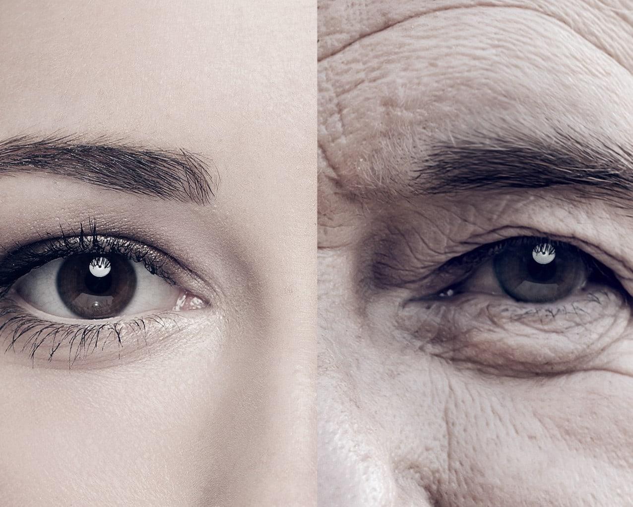 Close-up comparison of a younger and an older eye, side by side